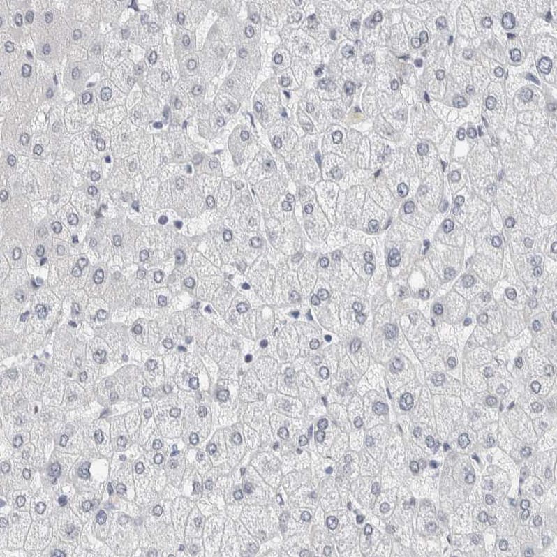 Staining of human liver shows no positivity in hepatocytes as expected.