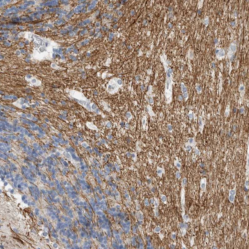 Staining of human cerebellum shows strong cytoplasmic positivity in white matter.
