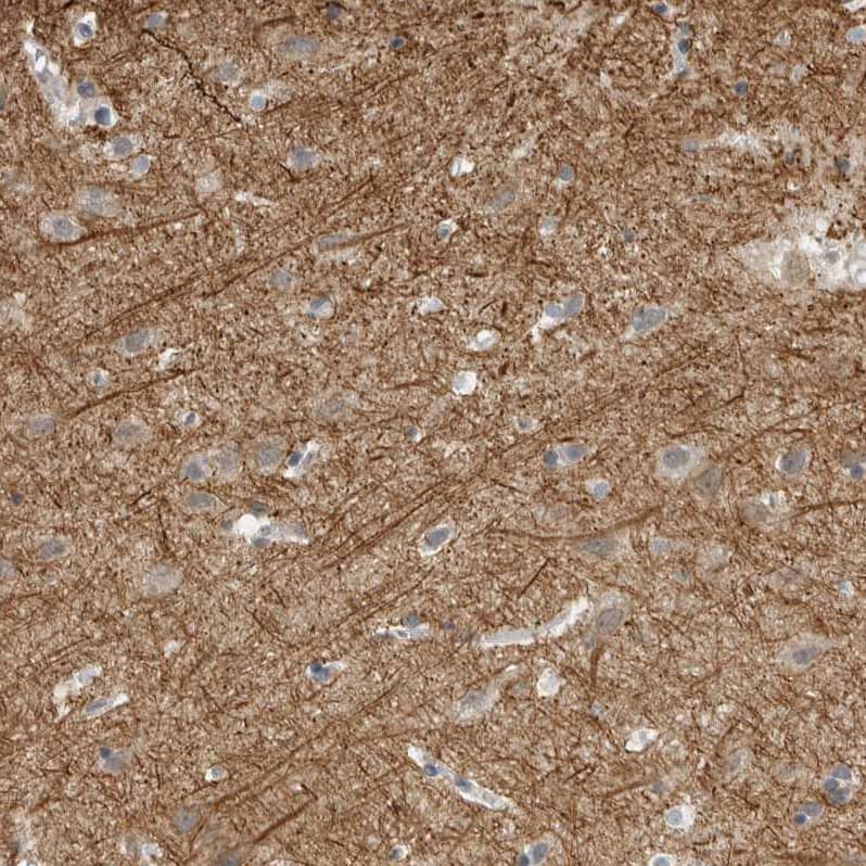 Staining of human cerebral cortex shows strong cytoplasmic positivity in neurons.