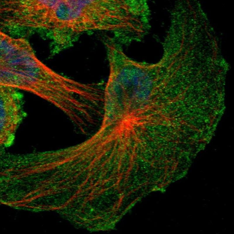 Immunocytochemistry/ Immunofluorescence NF2/Merlin Antibody - BSA Free