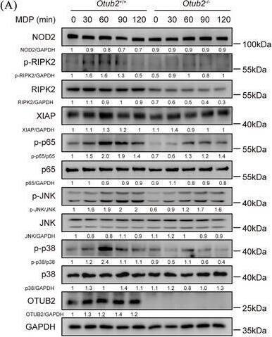 OTUB2 enhances MDP‐induced signalling by inhibiting the proteasomal degradation of RIPK2. (A) After stimulation with 200 ng/mL L18‐MDP for indicated periods of time, BMDMs derived from Otub2+/+ and Otub2–/– mice were lysed and analysed by Western blot with indicated antibodies. Densitometric quantification is shown in the figure. (B) Schematic diagram of MDP‐induced signalling. (C) The protein abundance of NOD2, RIPK2 and XIAP in Otub2+/+ and Otub2–/– BMDMs was determined by Western blot. (D–F) The relative protein levels of NOD2 (D), XIAP (E) and RIPK2 (F) in Otub2+/+ and Otub2–/– BMDMs. (G) The relative mRNA levels of Ripk2 in Otub2+/+ and Otub2–/– BMDMs were determined by qRT‐PCR. (H) RAW264.7 cells were transfected with FLAG‐Vector or FLAG‐OTUB2 plasmids for 24 h. Thereafter, cells were lysed and analysed by Western blot with indicated antibodies. (I) After treatment with 20 ng/mL CHX for indicated periods of time, BMDMs isolated from Otub2+/+ and Otub2–/– mice were lysed and analysed by Western blot with indicated antibodies. (J, K) BMDMs isolated from Otub2+/+ and Otub2–/– mice were treated with 20 uM MG132 (J) or 50 uM CQ (K) for 6 h or left untreated. Whole Cell lysates were analysed by Western blot with indicated antibodies. Representative immunoblots (upper panel) and quantification (lower panel) are shown. Data in D–G, J and K are shown as mean +/- SEM. ns, no significant difference. *p < .05, **p < .01. Image collected and cropped by CiteAb from the following open publication (//pubmed.ncbi.nlm.nih.gov/39358938), licensed under a CC-BY license. Not internally tested by Novus Biologicals.