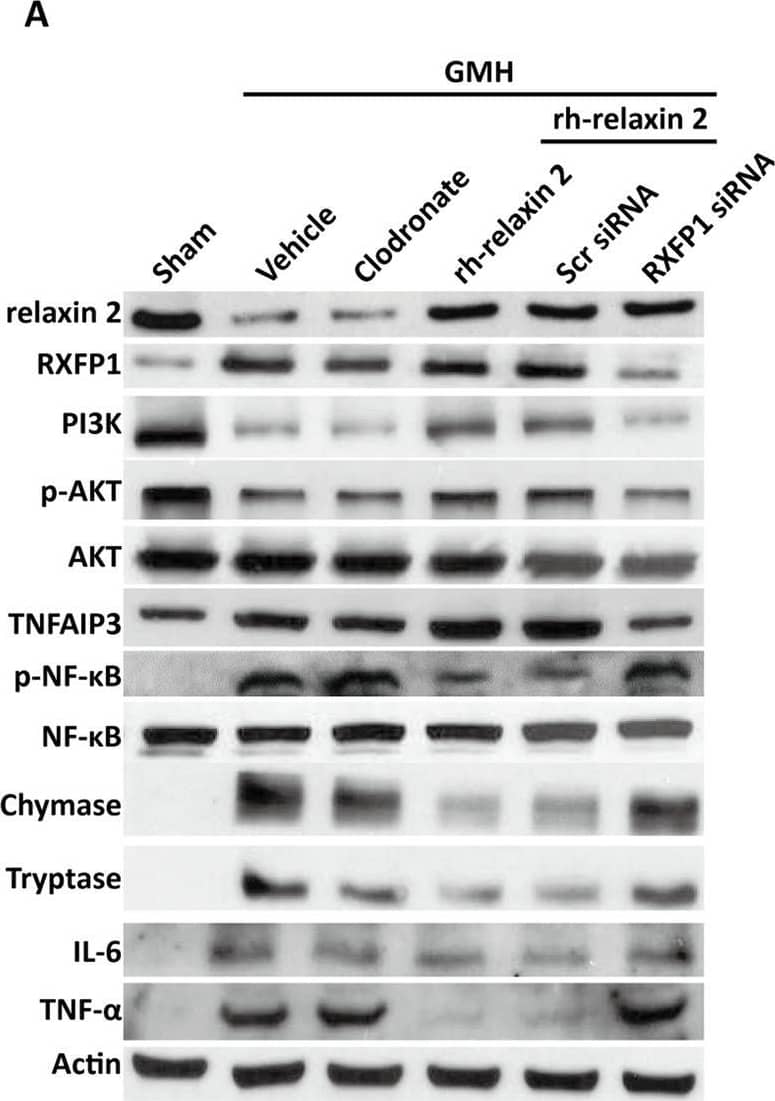 Western Blot NFkB2/NFkB p100 Antibody - BSA Free