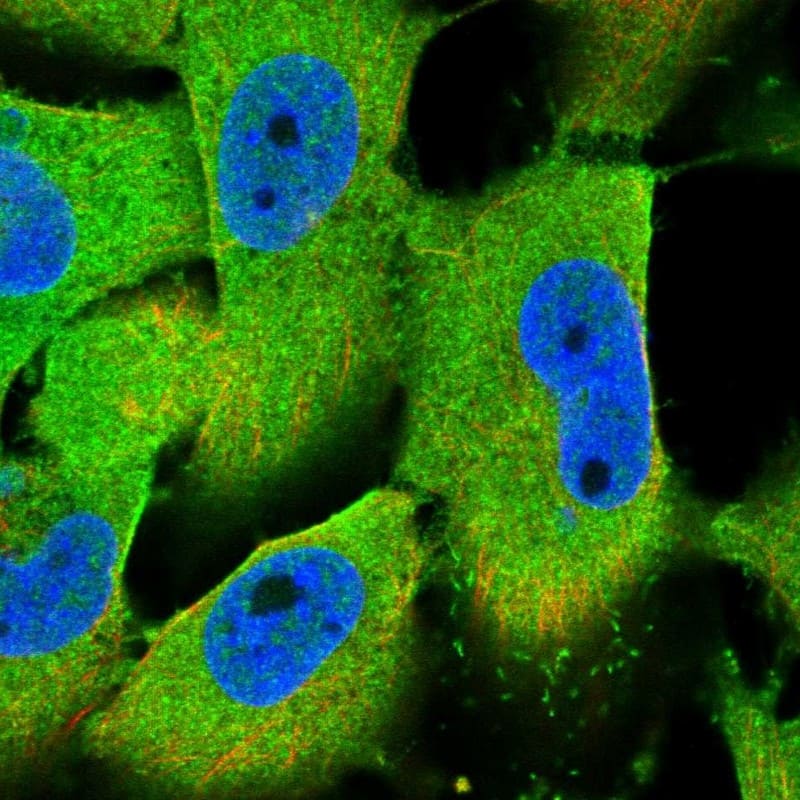 Staining of human cell line U-251 MG shows localization to cytosol.