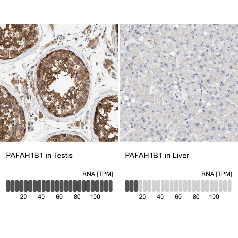 Analysis in human testis and liver tissues. Corresponding RNA-seq data are presented for the same tissues.