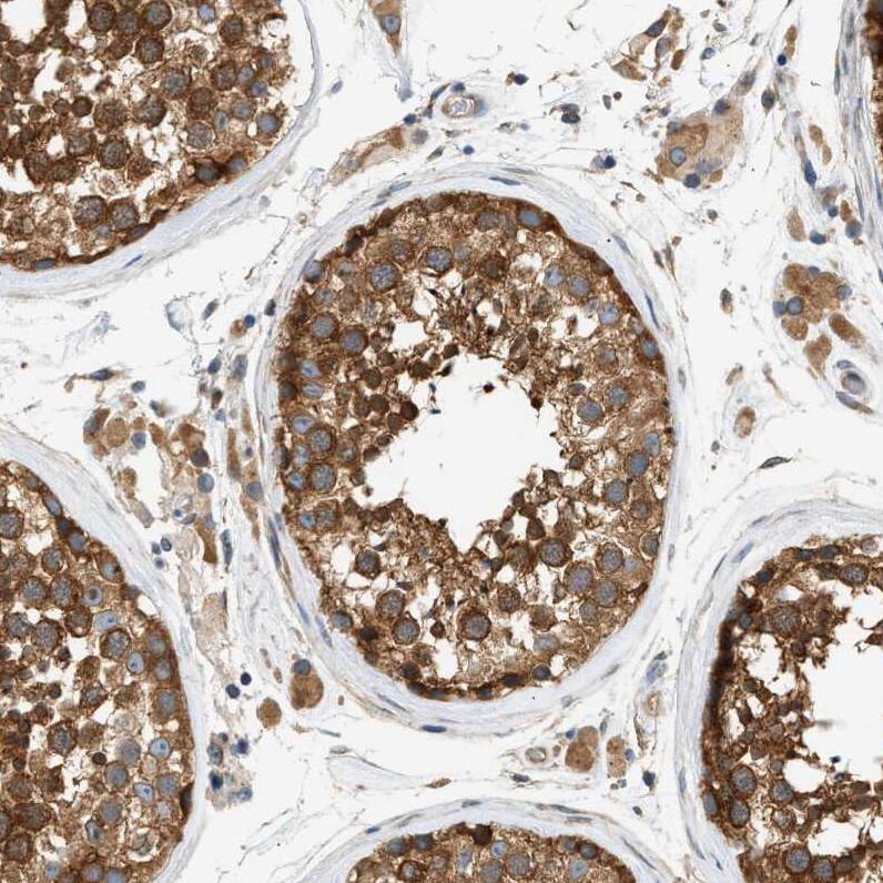 Staining of human testis shows strong cytoplasmic positivity in cells in seminiferous ducts.