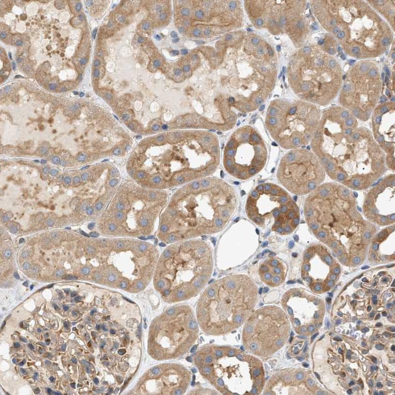 Staining of human kidney shows weak to moderate cytoplasmic positivity in cells in tubules.