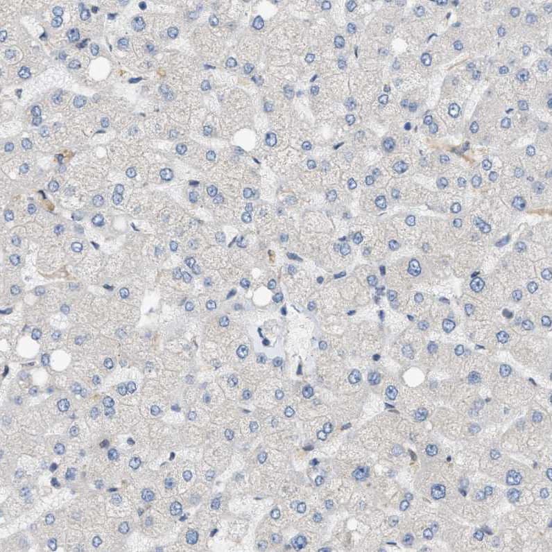 Staining of human liver shows no positivity in hepatocytes as expected.