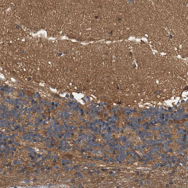 Staining of human cerebellum shows moderate positivity in neuropil.