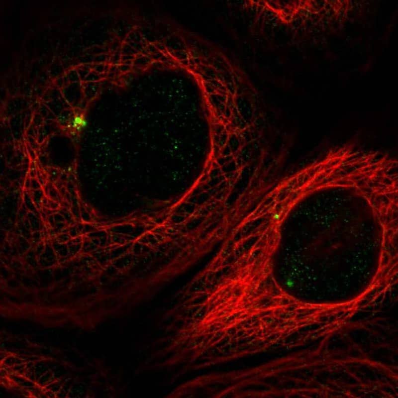 Staining of human cell line A-431 shows localization to centrosome.