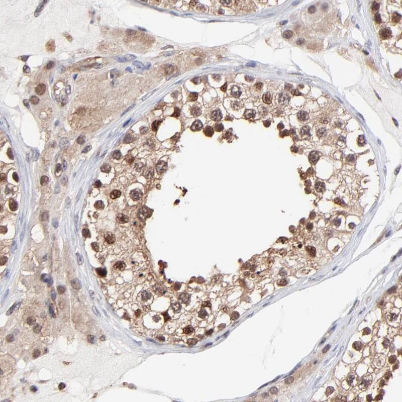 Staining of human testis shows moderate cytoplasmic and nuclear positivity in  cells in seminiferous ducts and Leydig cells.