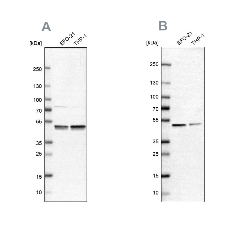 Analysis using NBP1-87797 (A) shows similar pattern to independent antibody NBP2-56743 (B).