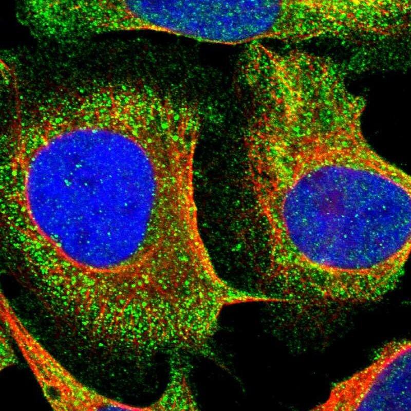 Staining of human cell line U-2 OS shows localization to plasma membrane & vesicles.