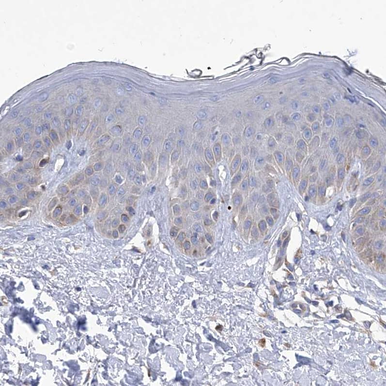 Staining of human skin shows no positivity in squamous epithelial cells as expected.