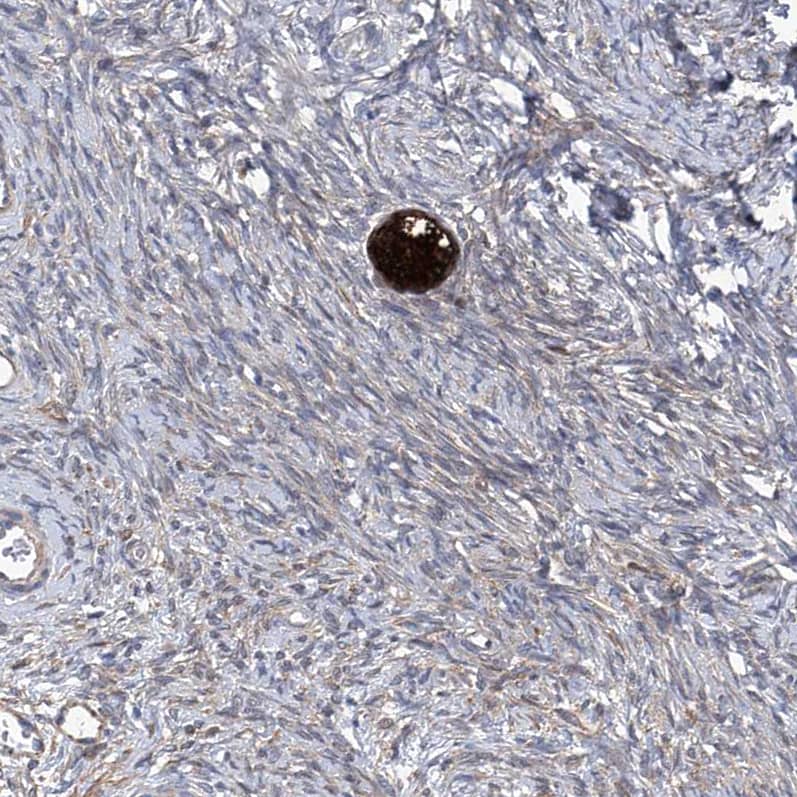 Staining of human ovary shows strong cytoplasmic positivity in follicle cells.