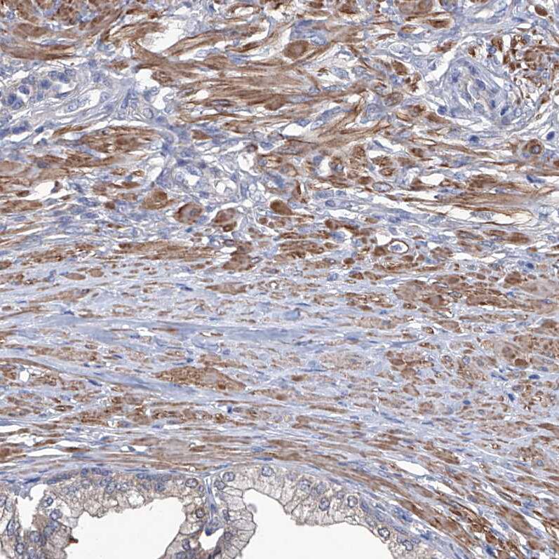 Staining of human prostate shows moderate cytoplasmic positivity in smooth muscle cells.