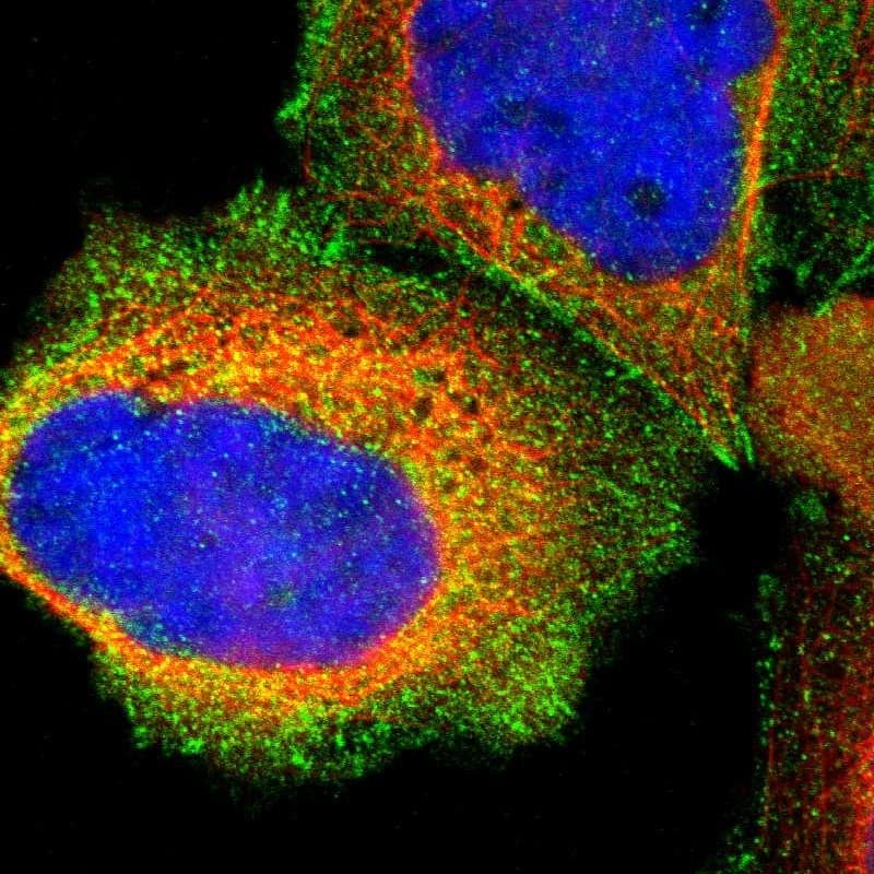Staining of human cell line A-431 shows localization to plasma membrane, cytosol & focal adhesion sites.