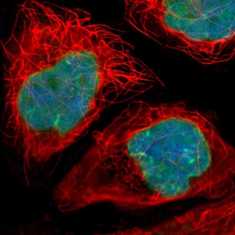 Immunocytochemistry/ Immunofluorescence Thymopoietin/LAP2 Antibody - BSA Free