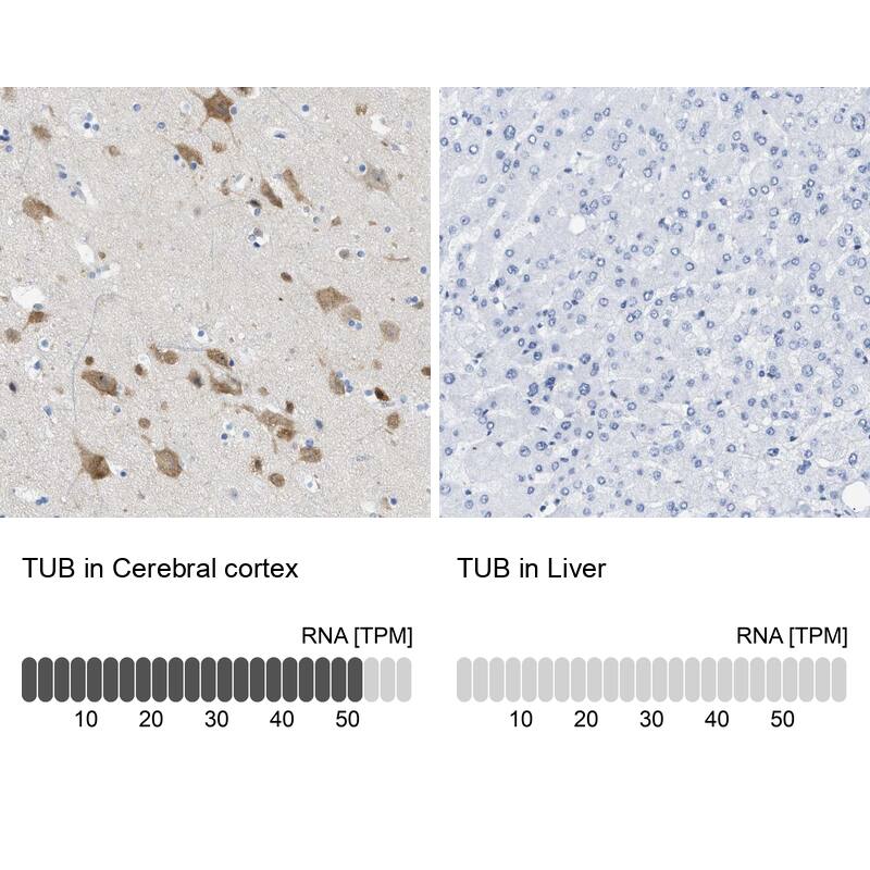 <b>Orthogonal Strategies Validation. </b>Analysis in human cerebral cortex and liver tissues. Corresponding RNA-seq data are presented for the same tissues.