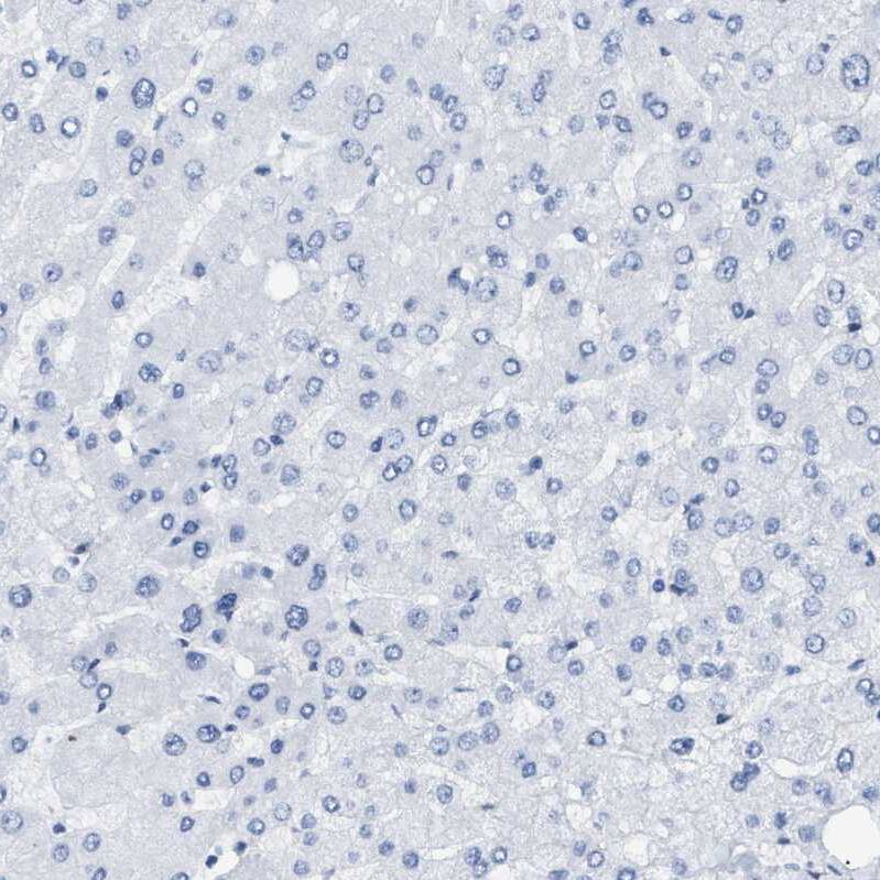 Staining of human liver shows no positivity in hepatocytes.