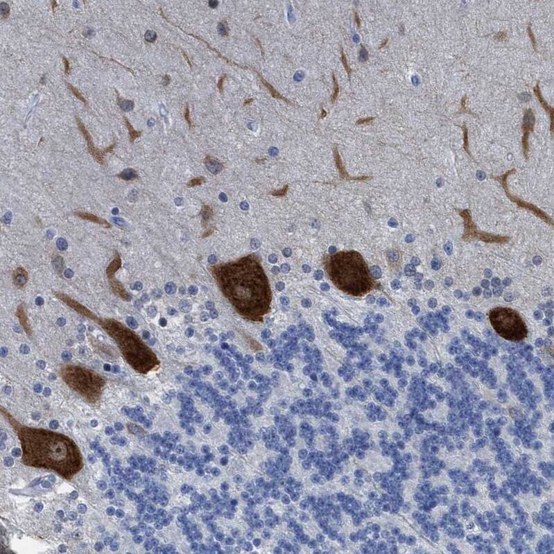 Staining of human cerebellum shows strong cytoplasmic positivity in Purkinje cells.