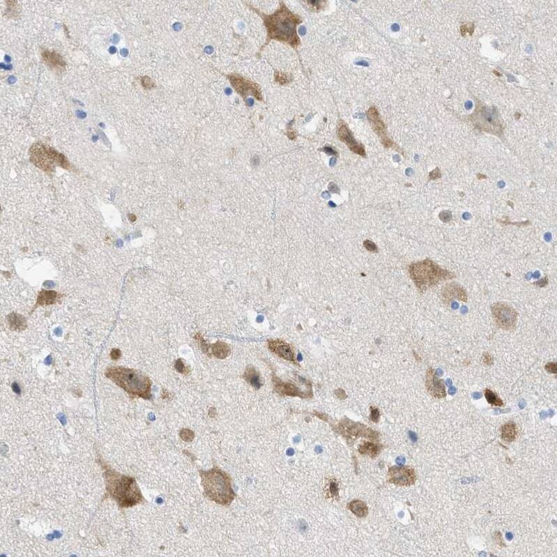 Staining of human cerebral cortex shows moderate cytoplasmic positivity in neurons.