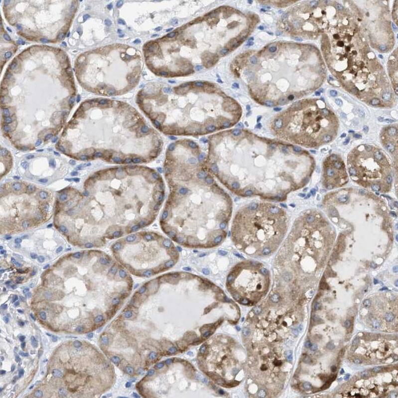 Staining of human kidney shows moderate cytoplasmic-membranous positivity in cells in tubules.