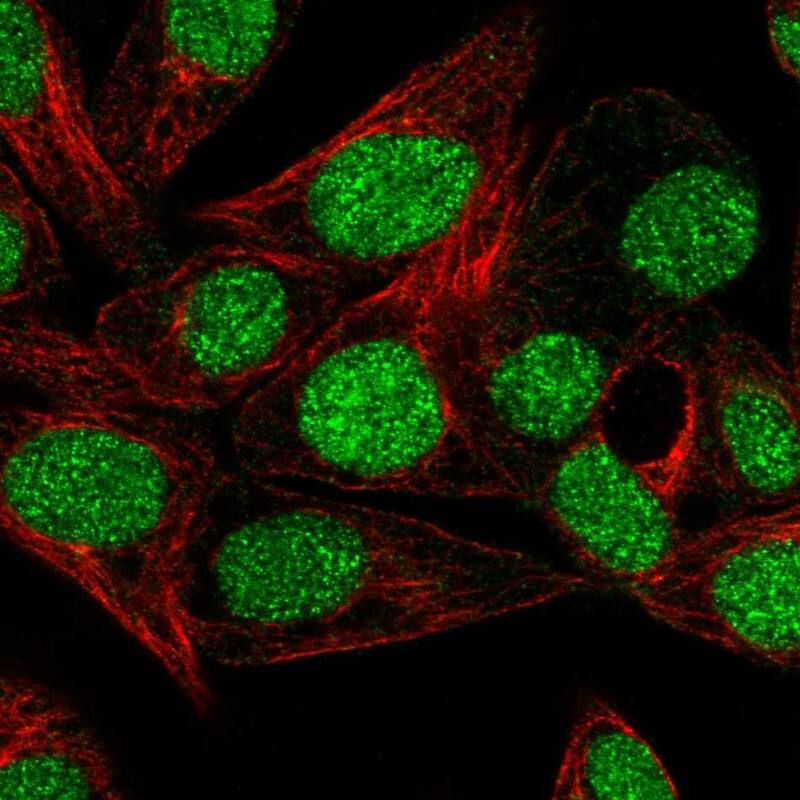 Immunocytochemistry/ Immunofluorescence MSS4 Antibody - BSA Free