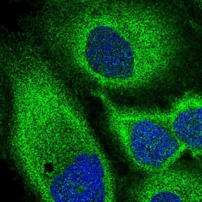 Staining of human cell line A-431 shows localization to nucleoli & cytosol.