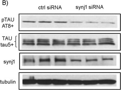 Western Blot: Synaptojanin 1 Antibody [NBP1-87842] - Reduction of pTau with synj1 knockdown in vitro. (A) The levels of pTau, Tau & synj1 protein in N2a cells after synj1 siRNA. Results are presented as % of levels in controls ± SEM. (B) A representative example of western blot analysis. (C) PIP2 levels. (D) Immunofluorescence staining of pTau (red) & Tau (green) with (E) quantification. Image collected & cropped by CiteAb from the following publication (//pubmed.ncbi.nlm.nih.gov/28900205), licensed under a CC-BY license. Not internally tested by Novus Biologicals.