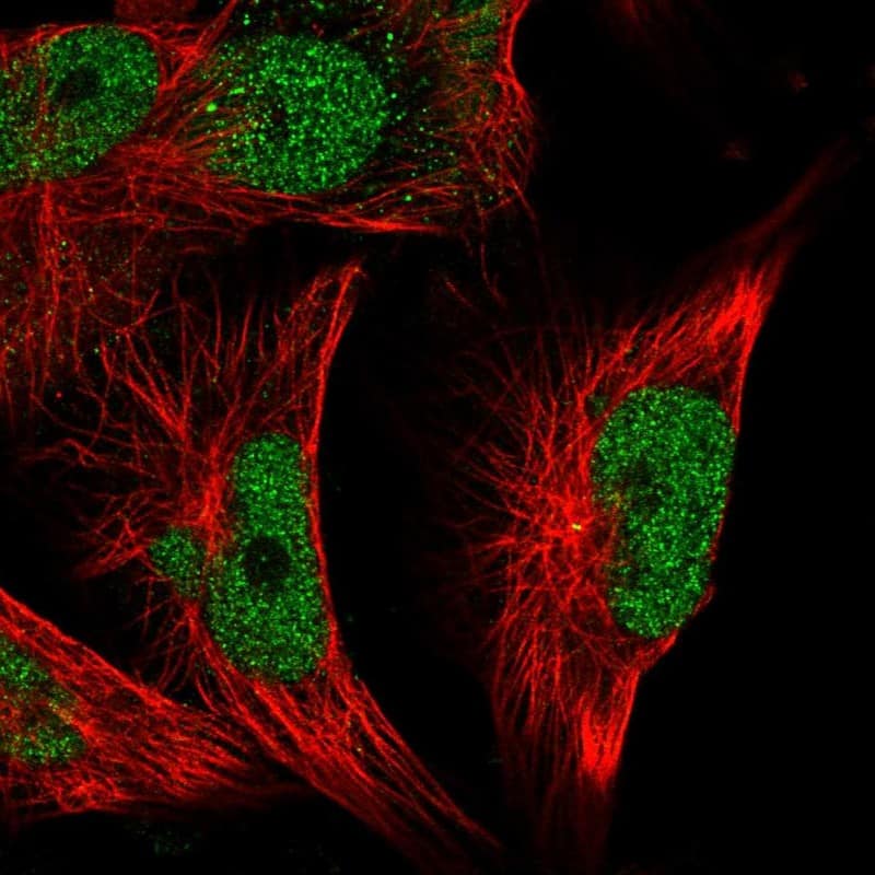 Staining of human cell line U-251 MG shows localization to nucleoplasm.