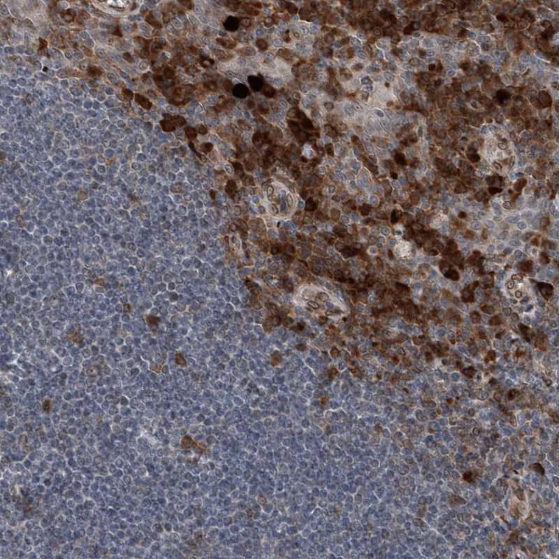 Staining of human tonsil shows strong nuclear and cytoplasmic positivity.