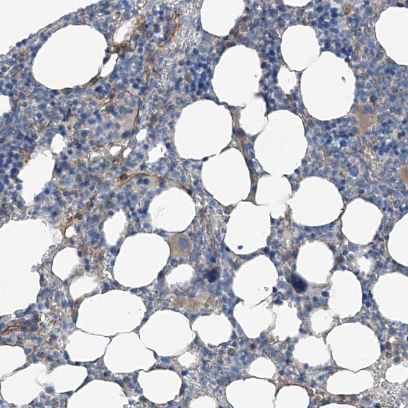 Staining of human bone marrow shows weak positivity in hematopoietic cells.