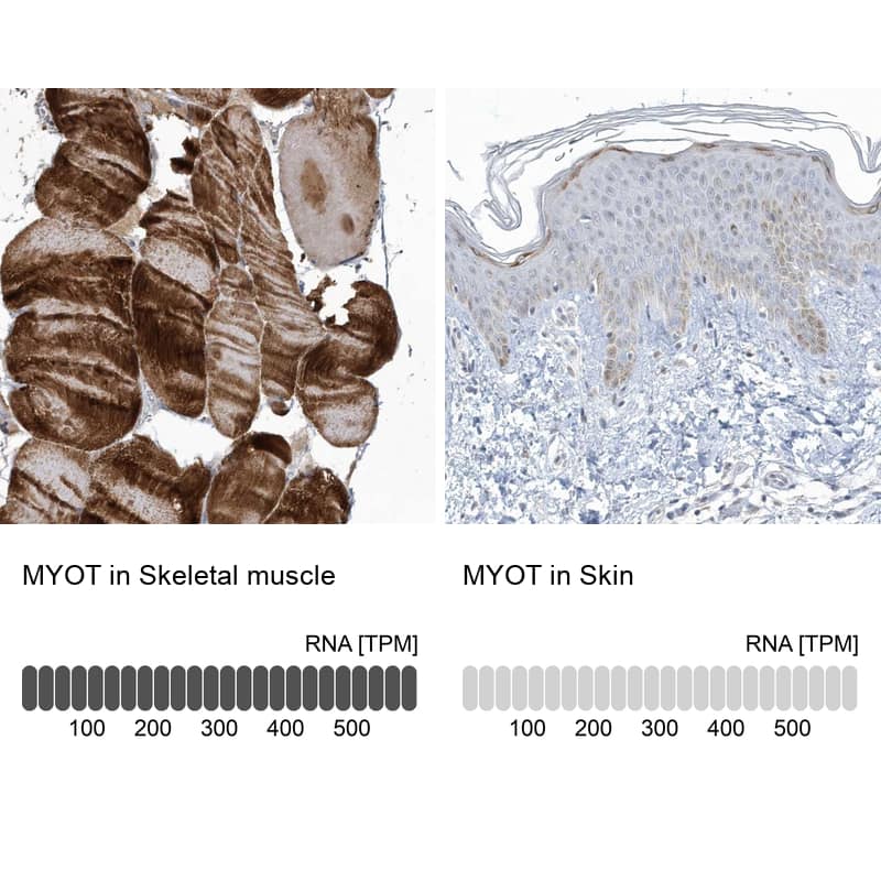 <b>Orthogonal Strategies Validation. </b>Analysis in human skeletal muscle and skin tissues.