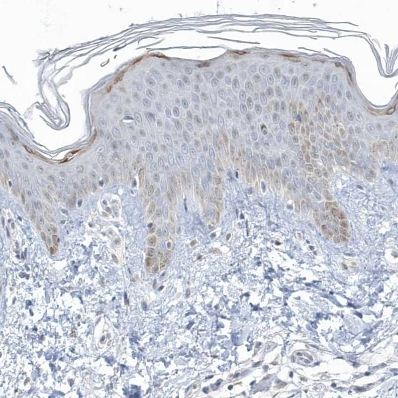 Staining of human skin shows low expression as expected.