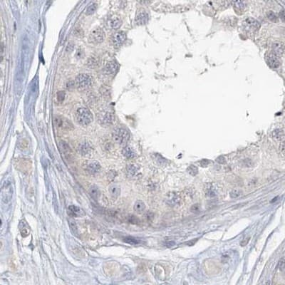 Staining of human testis.