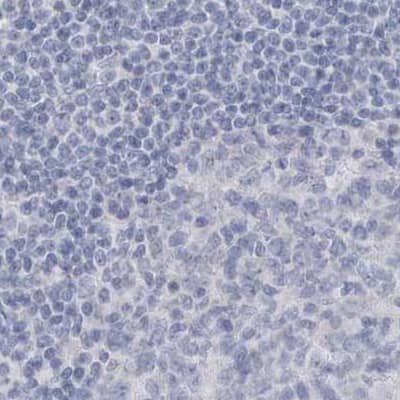 Staining of human lymph node.