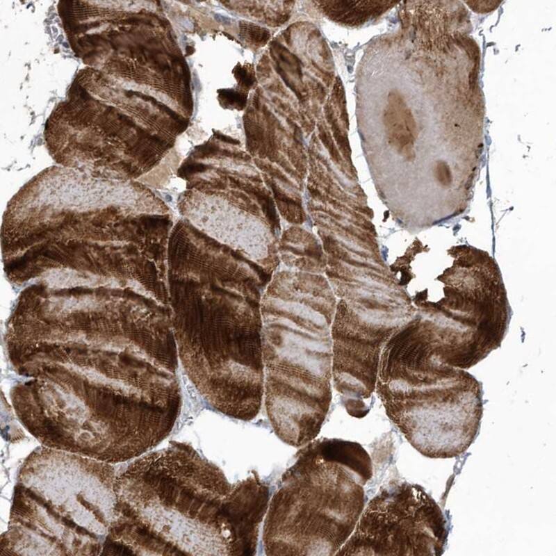 Staining of human skeletal muscle shows high expression.