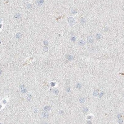 Staining of human cerebral cortex.