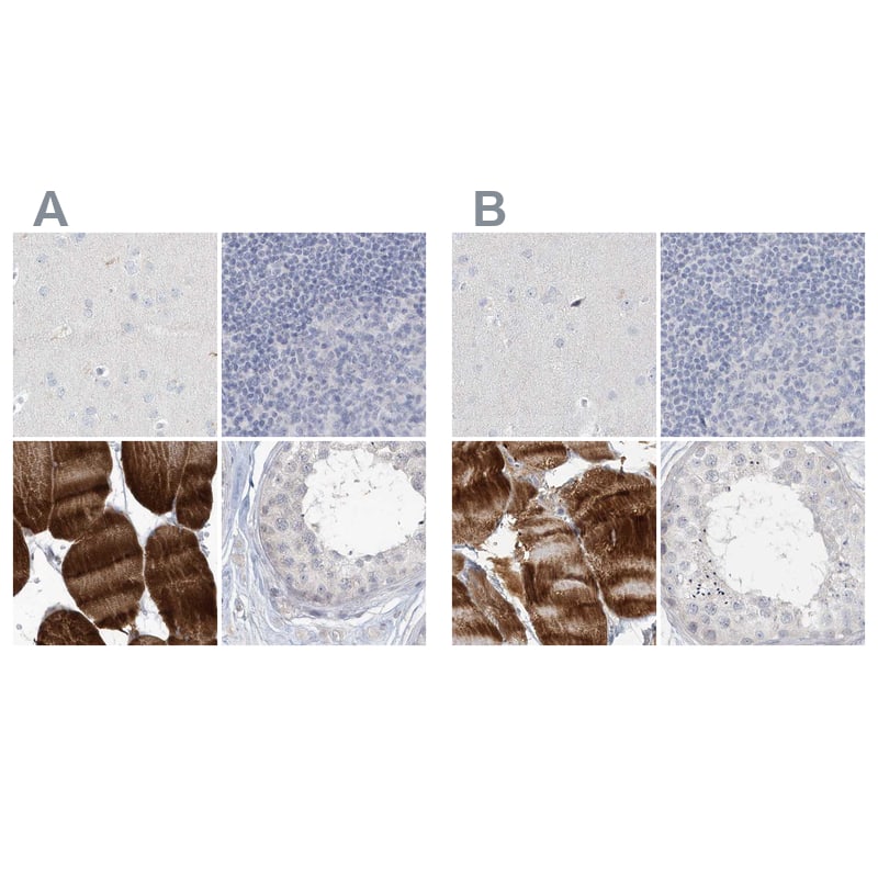 <b>Orthogonal Strategies Validation. </b>Staining of human cerebral cortex, lymph node, skeletal muscle and testis HPA037733 (A) shows similar protein distribution across tissues to independent antibody HPA037734 (B).