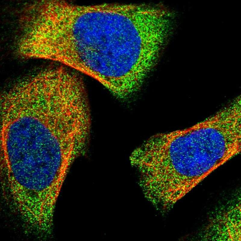 Staining of human cell line U-2 OS shows localization to cytosol.
