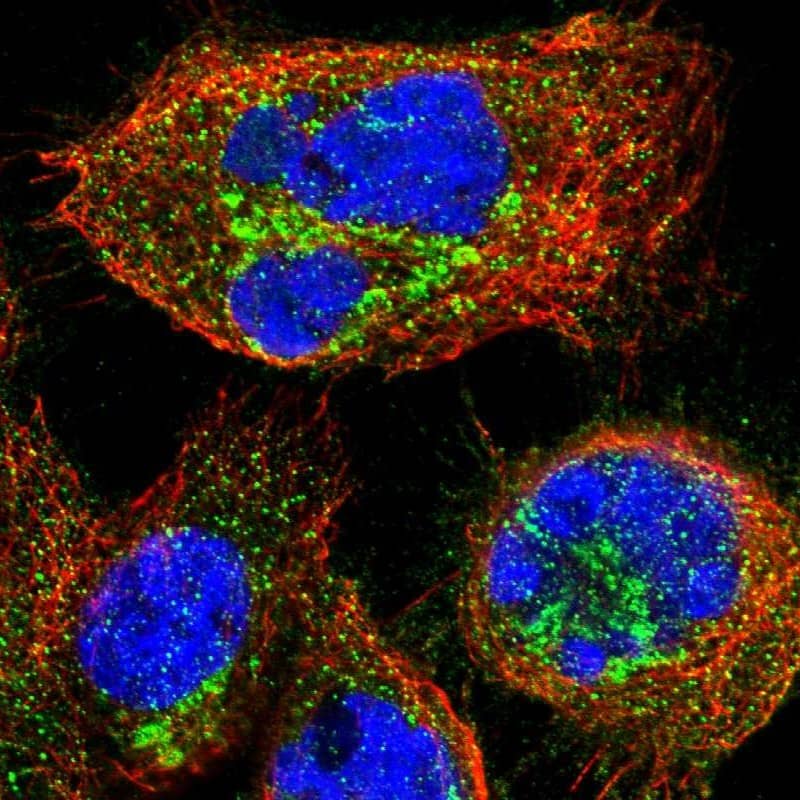 Staining of human cell line A-431 shows localization to the Golgi apparatus & vesicles.