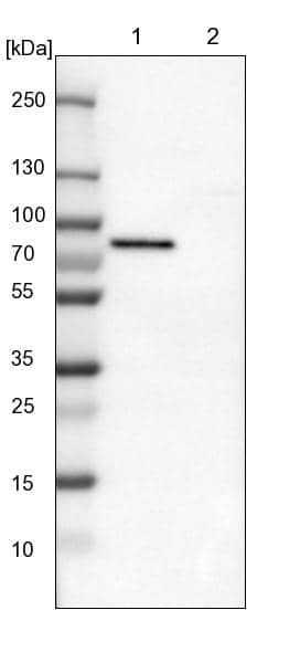 Lane 1: NIH-3T3 cell lysate (Mouse embryonic fibroblast cells)Lane 2: NBT-II cell lysate (Rat Wistar bladder tumour cells)