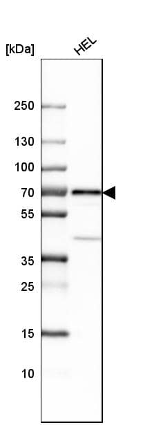 Analysis in human cell line HEL.