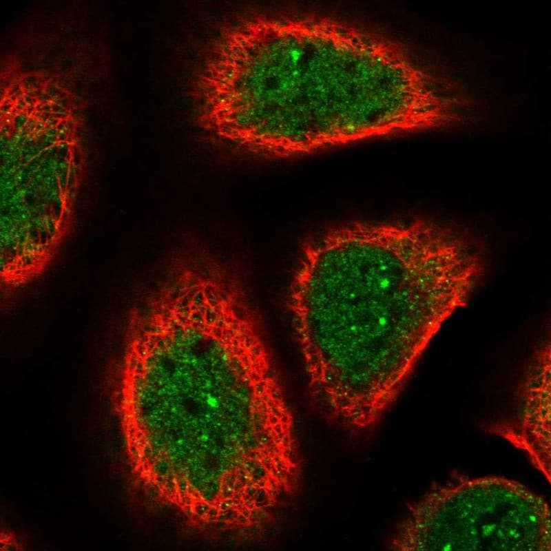 Staining of human cell line A-431 shows localization to nucleoplasm & nuclear bodies.