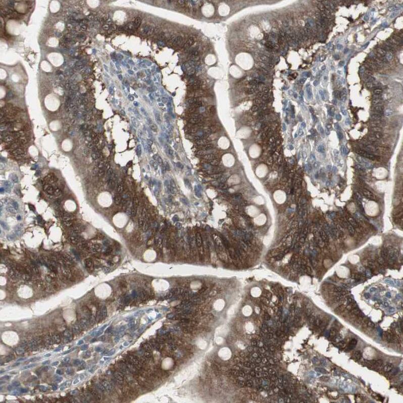 Staining of human small intestine shows strong cytoplasmic positivity in glandular cells.