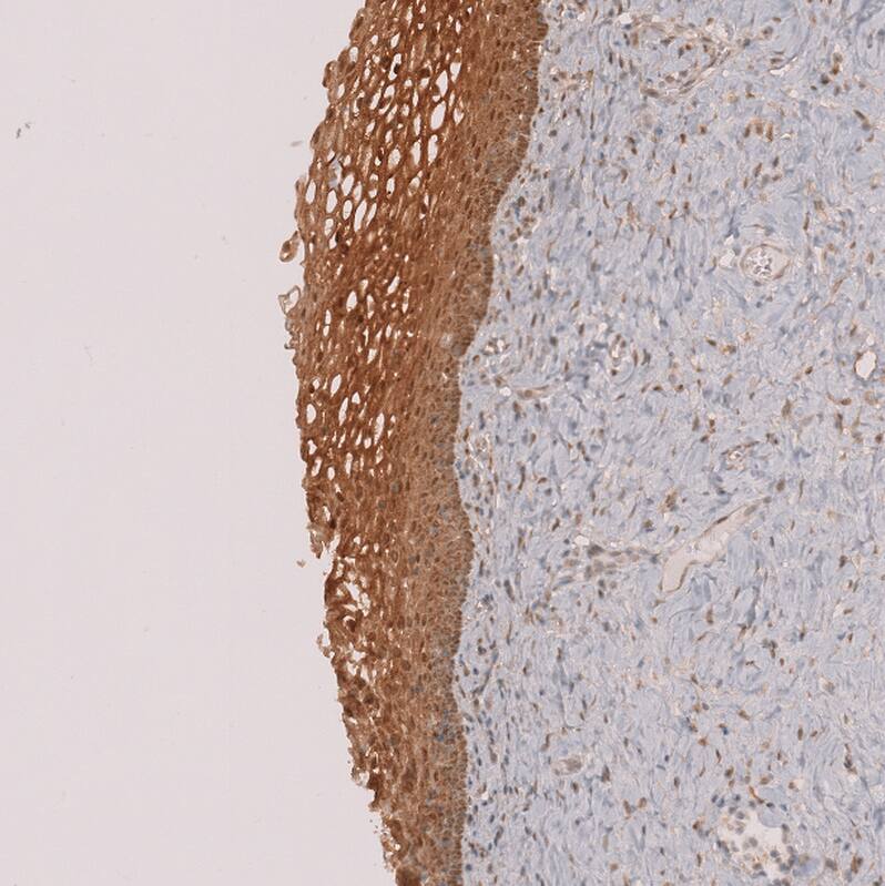 Staining of human cervix shows strong cytoplasmic positivity in squamous epithelial cells.