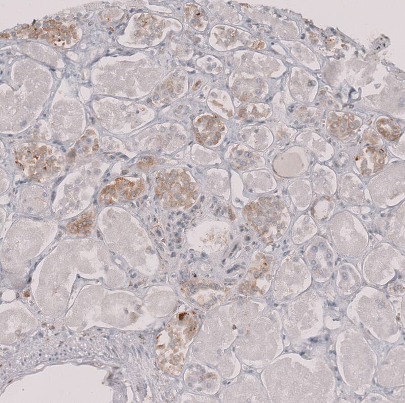 Staining of human kidney shows moderate cytoplasmic positivity in cells in tubules.