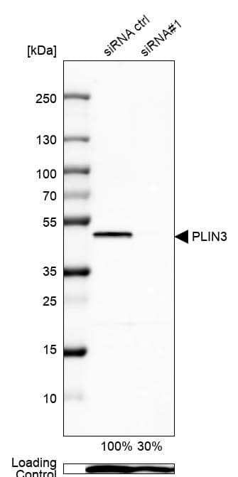 <b>Genetic Strategies Validation. </b>Analysis in U-87MG ATCC cells transfected with control siRNA, target specific siRNA probe #1, using Anti-PLIN3 antibody. Remaining relative intensity is presented. Loading control: Anti-PPIB.
