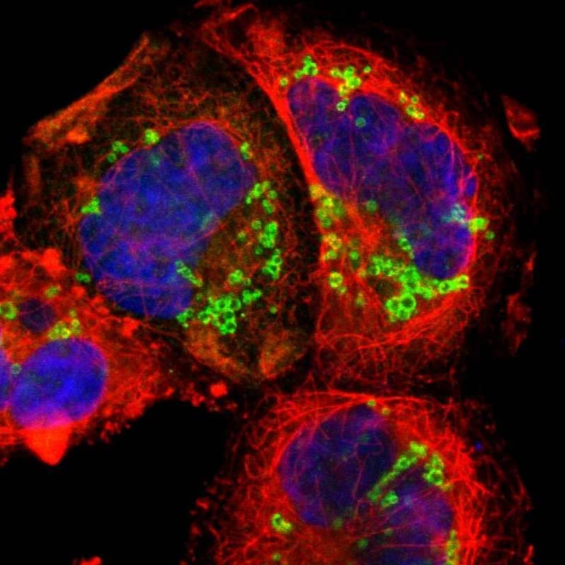 Staining of human cell line A-431 shows localization to lipid droplets.