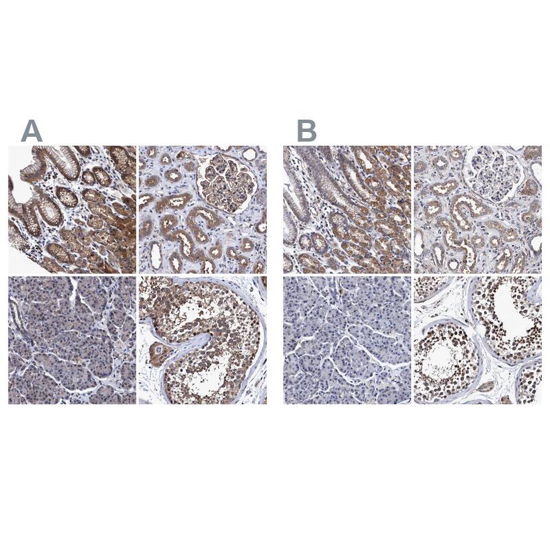 <b>Independent Antibodies Validation. </b>Staining of human gastrointestinal, kidney, pancreas and testis using Anti-CALCOCO2 antibody NBP1-87872 (A) shows similar protein distribution across tissues to independent antibody NBP1-87874 (B).